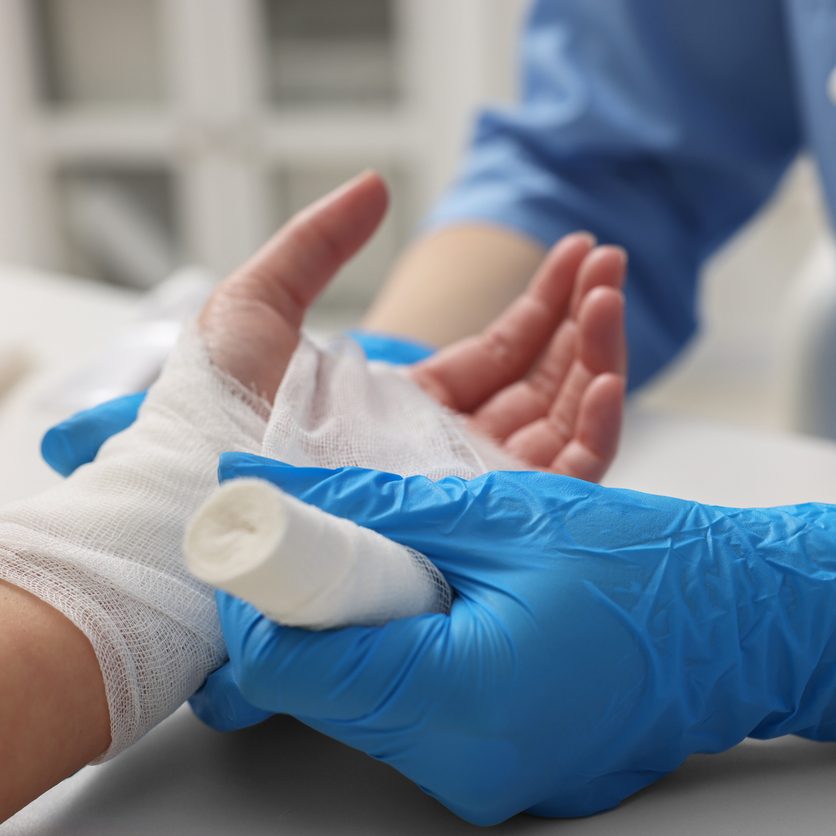 Doctor bandaging patient's burned hand in hospital, closeup