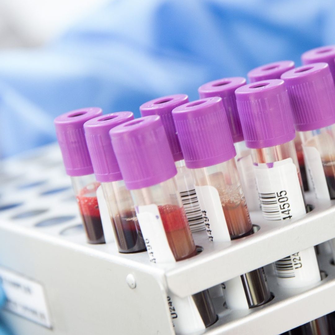 lab testing headland al